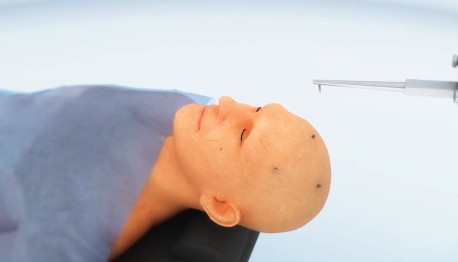 华科医疗Sinovation神经外科手术机器人医疗器械动画图片